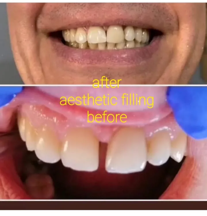 Alanya HEALTHY TEETH Dental Aesthetic — Медицина в Аланье: Онлайн-заказ, цены и отзывы