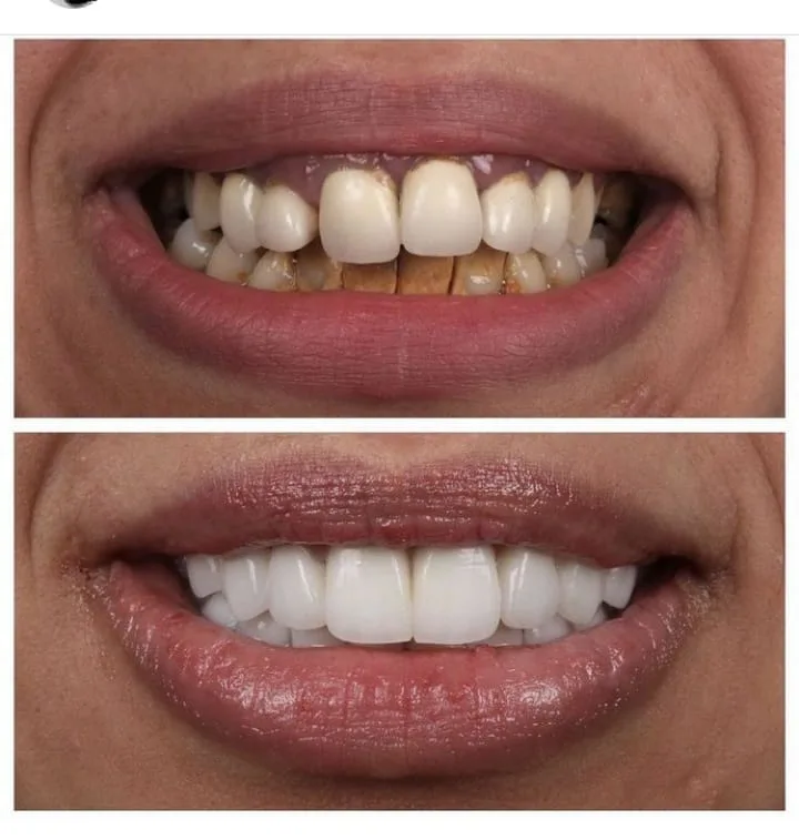 Alanya HEALTHY TEETH Dental Aesthetic — Медицина в Аланье: Онлайн-заказ, цены и отзывы