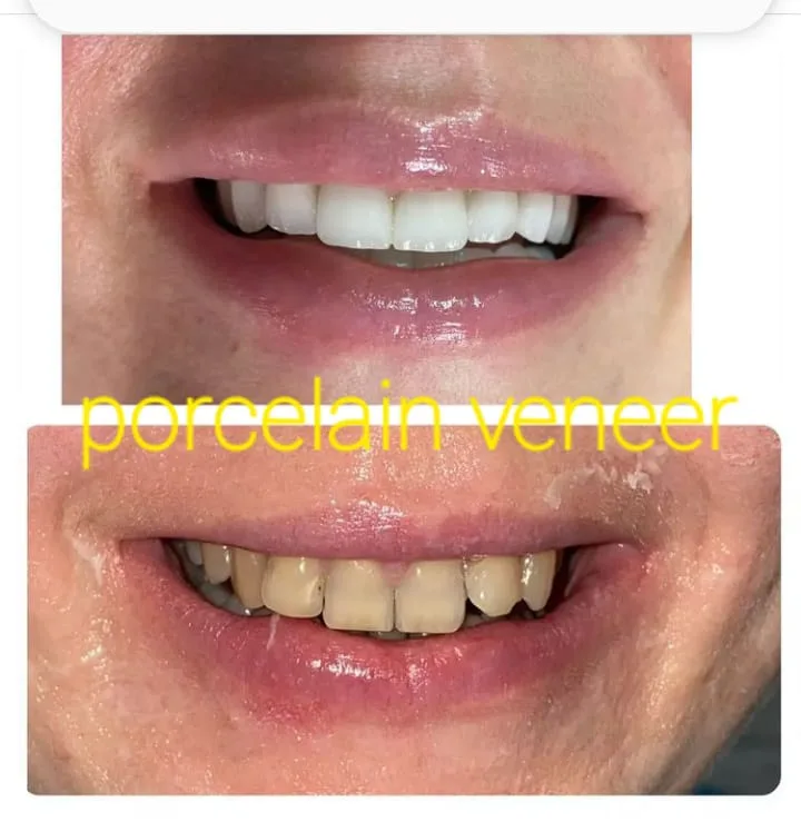 Alanya HEALTHY TEETH Dental Aesthetic — Медицина в Аланье: Онлайн-заказ, цены и отзывы
